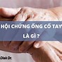 Hội Chứng Ống Cổ Tay Bên Phải